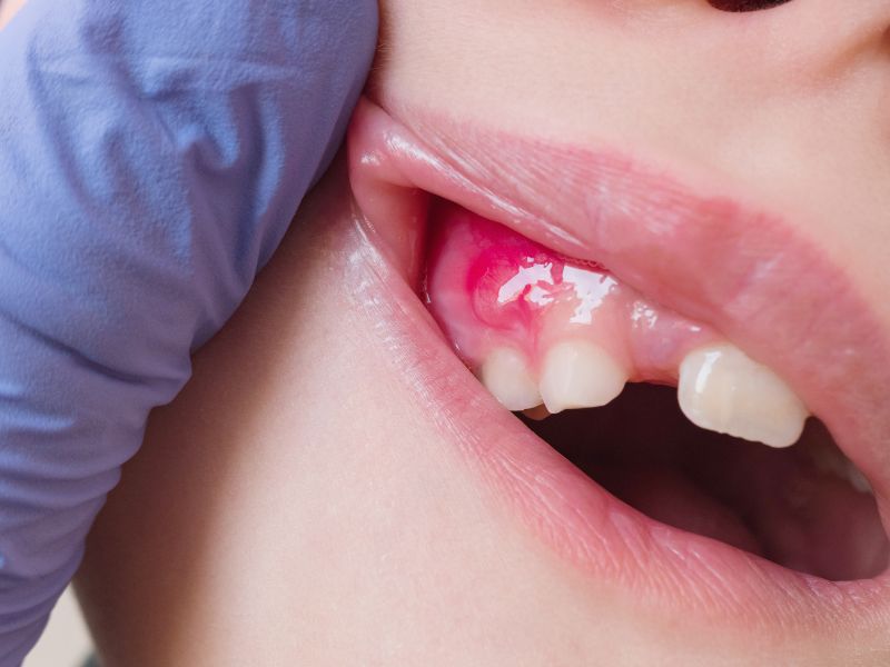 Dr Silviu Oratie - Dentiste Granville - Pédodontie