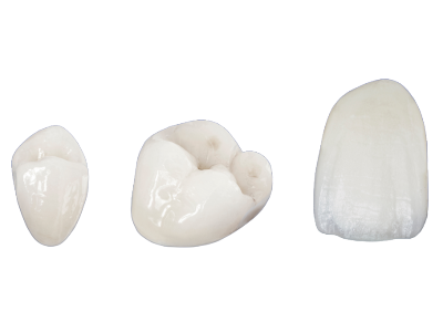 Dr Silviu Oratie - Dentiste Granville - Couronne dentaire