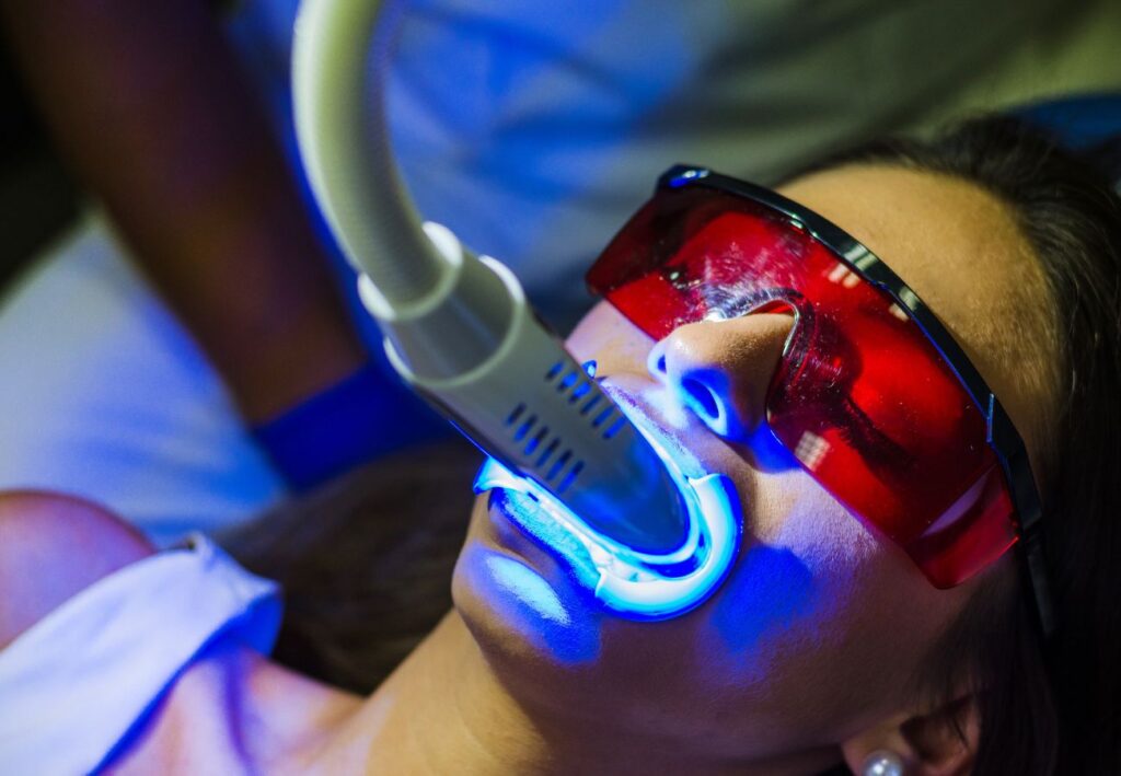 Dr Silviu Oratie - Dentiste Granville - Eclaircissement dentaire