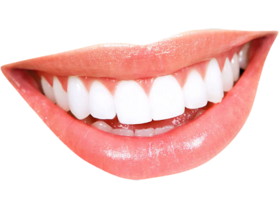 Dr Silviu Oratie - Dentiste Granville - Sourire esthétique