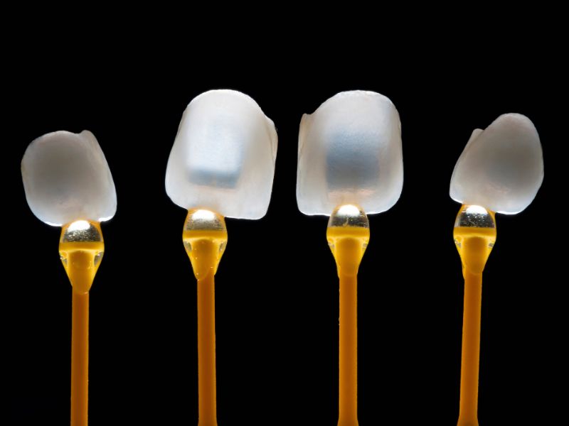 Dr Silviu Oratie - Dentiste Granville - Facettes