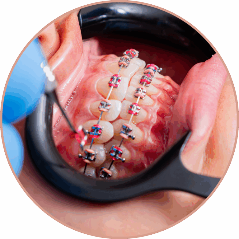 Dr Silviu Oratie - Dentiste Granville - Orthodontie