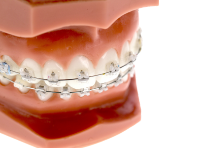 Dr Silviu Oratie - Dentiste Granville - Orthodontie