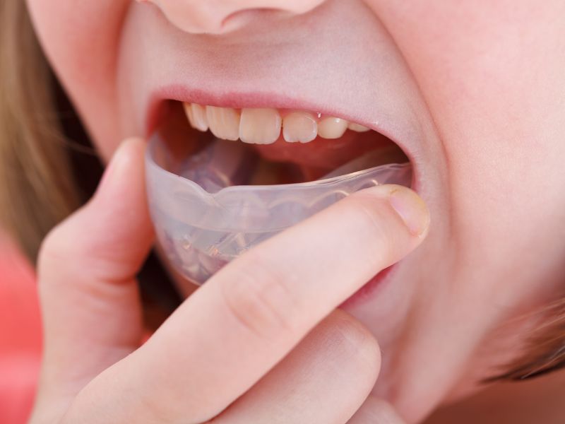 Dr Silviu Oratie - Dentiste Granville - Orthopédie dento faciale